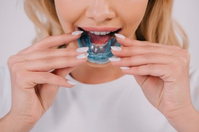 Ortodoncia Invisible Aligner